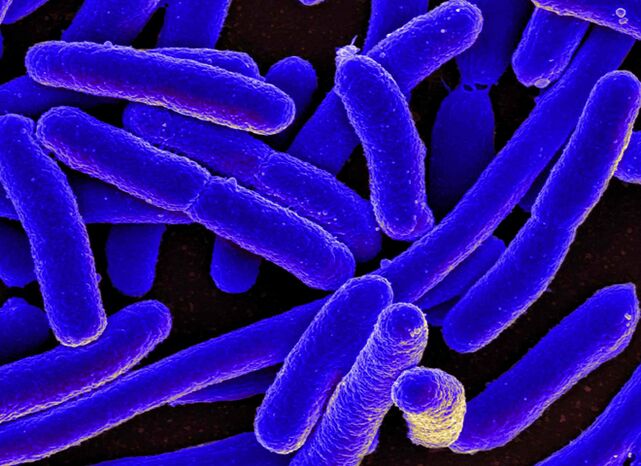 Το E. coli πυροδοτεί συχνότερα την ανάπτυξη κυστίτιδας στις γυναίκες